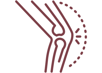 Joint reconstruction4