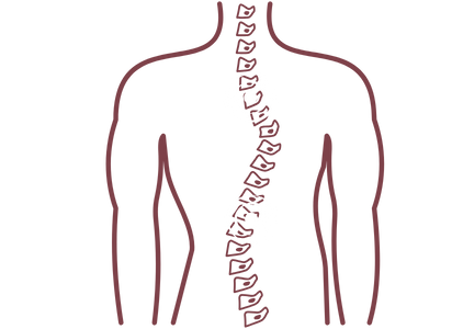 Spine deformity correction6