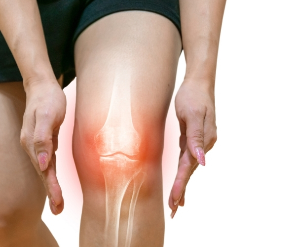 Joint Reconstruction